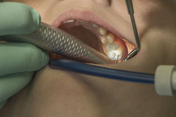 Have you already been to your regular teeth inspection? - бесплатный image #309459