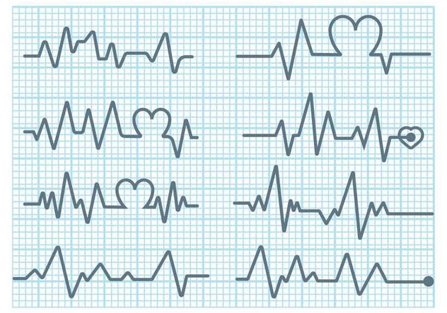 Heart Monitor Vector - Kostenloses vector #371119