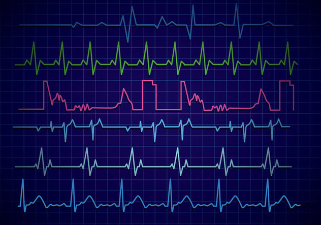 Heart Monitor Vector - Kostenloses vector #375669