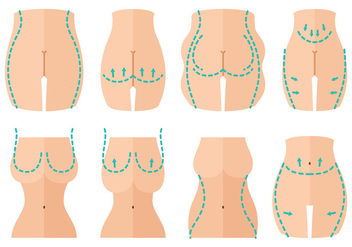Free Plastic Surgery Icons Vector - Free vector #405969